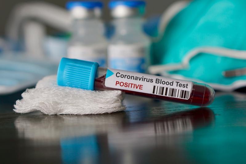 3   новых случая коронавируса подтвердили в Алматы   