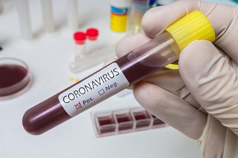 Первый случай заболевания коронавирусом в Павлодарской области