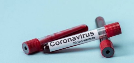 Расширяются категории обследуемых на коронавирус людей   