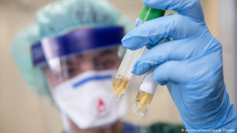 Қазақстан ғалымдары коронавирусқа қарсы вакцинаны тышқанға сынап көрді