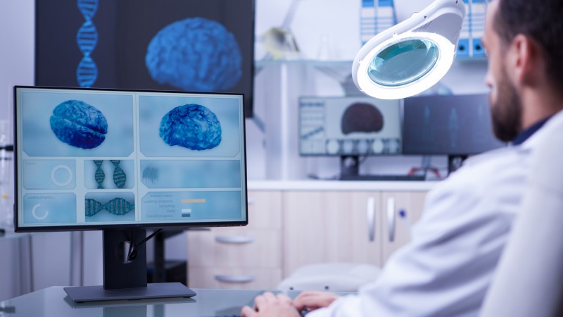 Нужно ли делать МРТ мозга после коронавируса, ответила врач   
