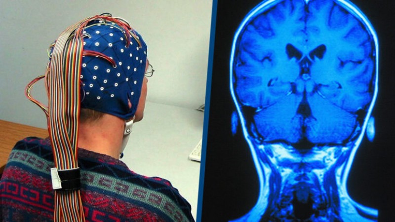 Ученые смогли подключить человеческий мозг к компьютеру   