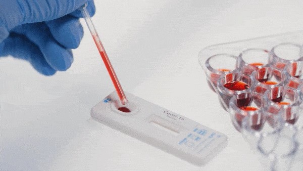 Изобретен экспресс-тест на коронавирус который можно использовать дома
